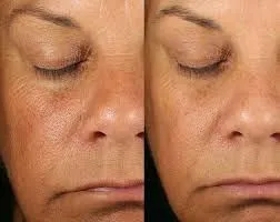 🚀 Skincare del Futuro: Cómo la Tecnología Está Transformando la Forma en Que Cuidamos Nuestra Piel